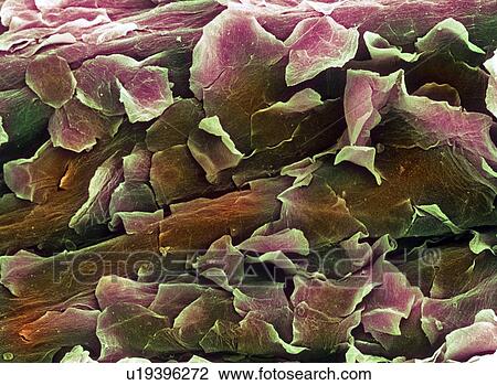 Stock Image - Coloured SEM of healthy skin. Fotosearch