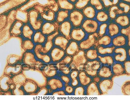 Stock Photograph - Coloured TEM of a cluster of influenza viruses. Fotosearch