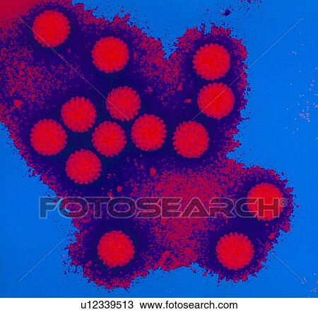 Coloured TEM of a cluster of rotaviruses View Large Photo Image Stock Image - Coloured TEM of a cluster of rotaviruses. Fotosearch