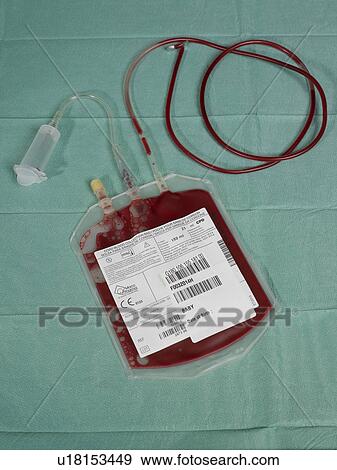 Cord blood for stem cell harvesting View Large Photo Image Stock Photo - Cord blood for stem cell harvesting. Fotosearch