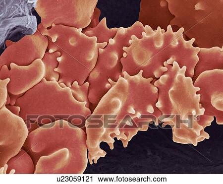 Stock Image - Crenated red blood cells, SEM. Fotosearch