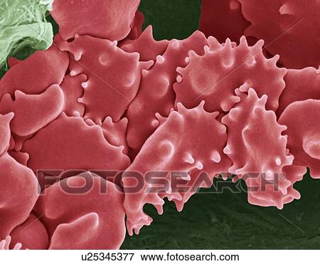 Stock Photo - Crenated red blood cells, SEM. Fotosearch