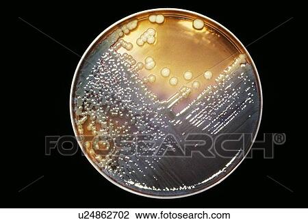 Stock Image - Cultured Enterobacter bacteria. Fotosearch