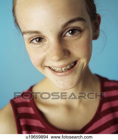 Dental braces View Large Photo Image Picture - Dental braces. Fotosearch