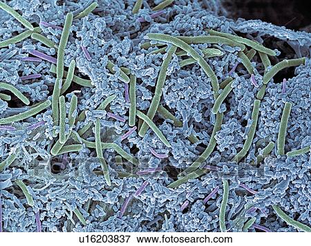 Stock Photo - Dental plaque, SEM. Fotosearch