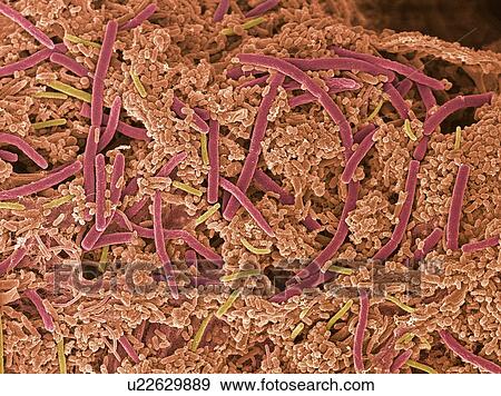 Dental plaque, SEM View Large Photo Image Stock Photo - Dental plaque, SEM. Fotosearch