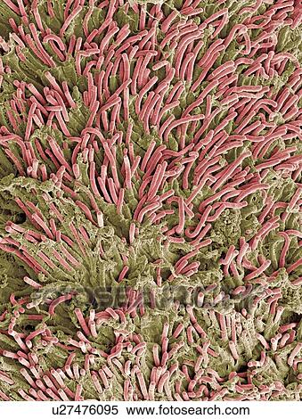 Dental plaque, SEM View Large Photo Image Stock Photography - Dental plaque, SEM. Fotosearch