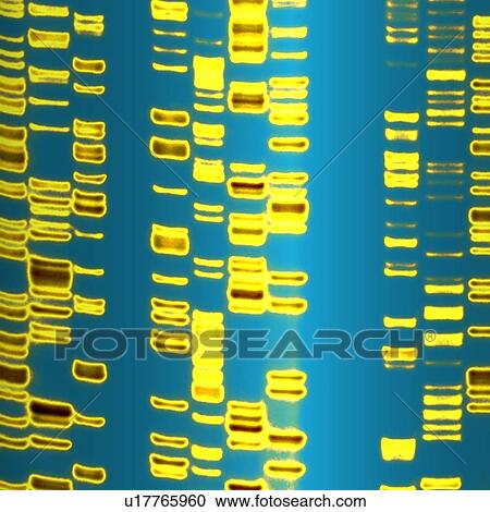 DNA autoradiogram, artwork View Large Photo Image Stock Image - DNA autoradiogram, artwork. Fotosearch