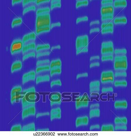 DNA autoradiogram, artwork View Large Photo Image Stock Image - DNA autoradiogram, artwork. Fotosearch