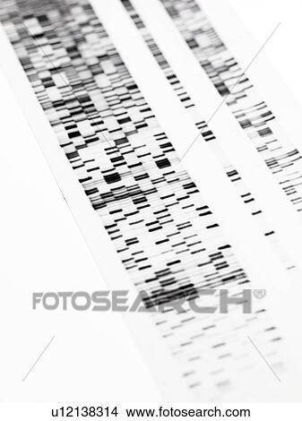 Picture - DNA autoradiogram. Fotosearch