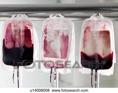 Stock Photo - Donor blood processing. Fotosearch