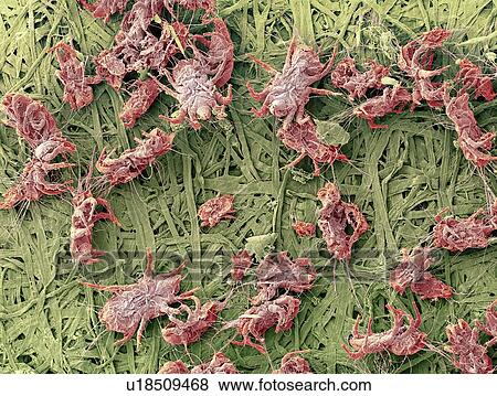 Dust mites, SEM View Large Photo Image Stock Photo - Dust mites, SEM. Fotosearch