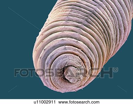 Earthworm, SEM View Large Photo Image Stock Image - Earthworm, SEM. Fotosearch