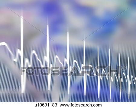 Stock Image - ECG, computer artwork. Fotosearch