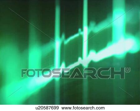 Stock Photo - ECG, computer artwork. Fotosearch