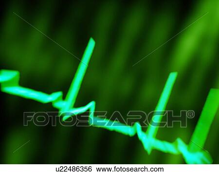 Stock Photograph - ECG, computer artwork. Fotosearch