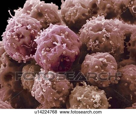 Stock Photo - Embryonic stem cells, SEM. Fotosearch