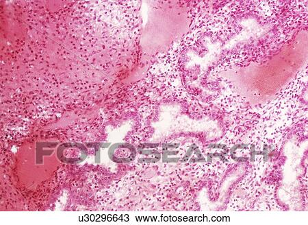 Endometrium View Large Photo Image Stock Image - Endometrium. Fotosearch