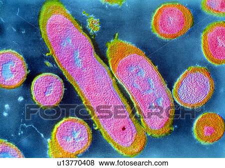 Stock Photo - Erysipelothrix rhusiopathiae bacteria. Fotosearch