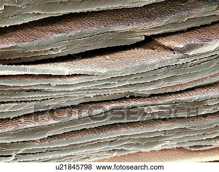 Stock Photo - Eye lens cells, SEM. Fotosearch