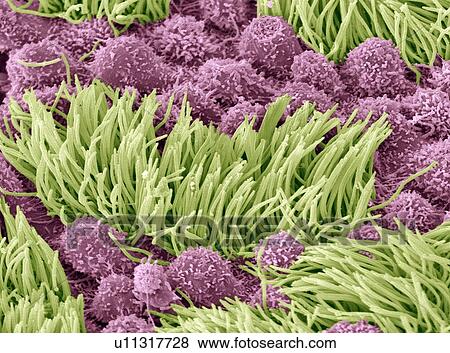 Stock Photo - Fallopian tube, SEM. Fotosearch