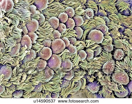 Fallopian tube, SEM View Large Photo Image Stock Photo - Fallopian tube, SEM. Fotosearch