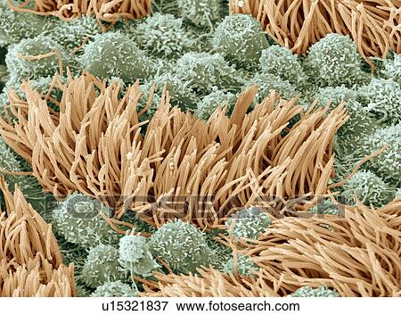 Fallopian tube, SEM View Large Photo Image Stock Photo - Fallopian tube, SEM. Fotosearch