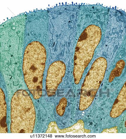 Fallopian tube, TEM View Large Photo Image Stock Photo - Fallopian tube, TEM. Fotosearch