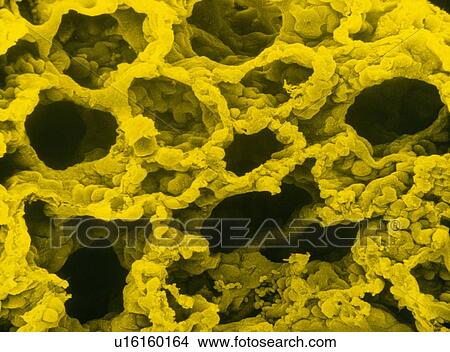 False col SEM of lung View Large Photo Image Picture - False col SEM of lung. Fotosearch