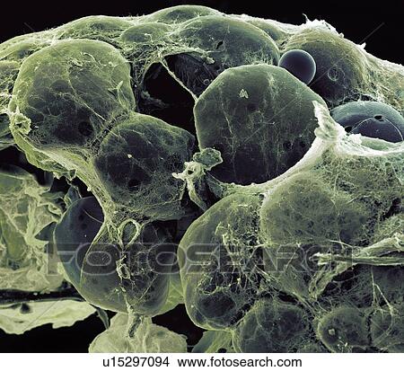Picture - Fat tissue, SEM. Fotosearch
