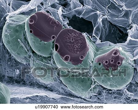 Stock Image - Fat tissue, SEM. Fotosearch