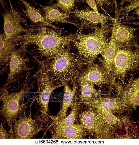 Stock Photography - Fibroblast cells. Fotosearch