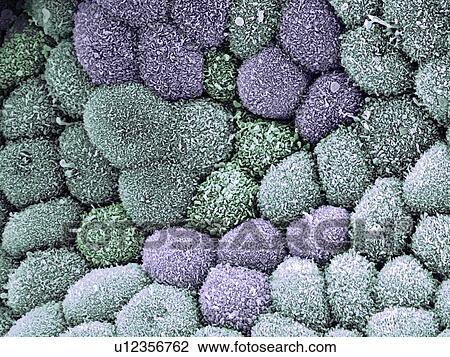 Stock Image - Gall bladder surface, SEM. Fotosearch