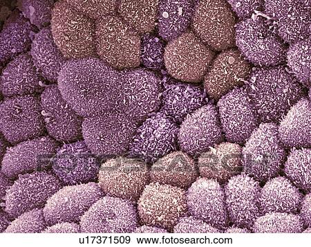 Stock Photo - Gall bladder surface, SEM. Fotosearch