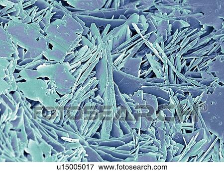 Gallstone, SEM View Large Photo Image Stock Photo - Gallstone, SEM. Fotosearch