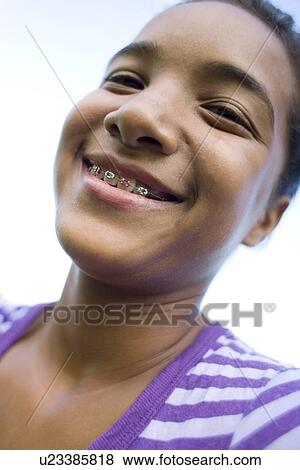 Stock Photo - Girl wearing dental braces. Fotosearch