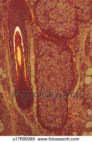 Stock Photography - Hair follicle. Fotosearch