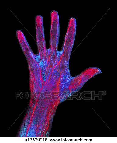 Hand blood supply, artwork View Large Photo Image Stock Photograph - Hand blood supply, artwork. Fotosearch