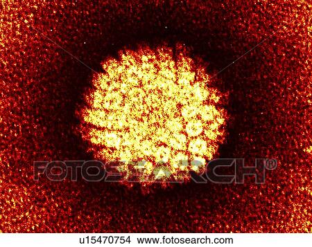Picture - Herpes virus particle, TEM. Fotosearch