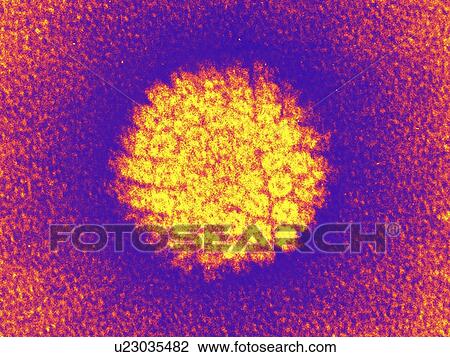 Stock Image - Herpes virus particle, TEM. Fotosearch