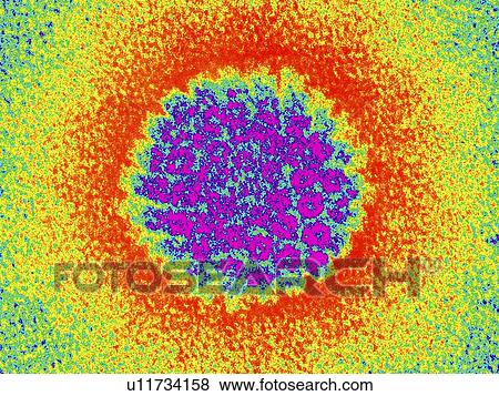 Stock Photo - Herpes virus particle, TEM. Fotosearch