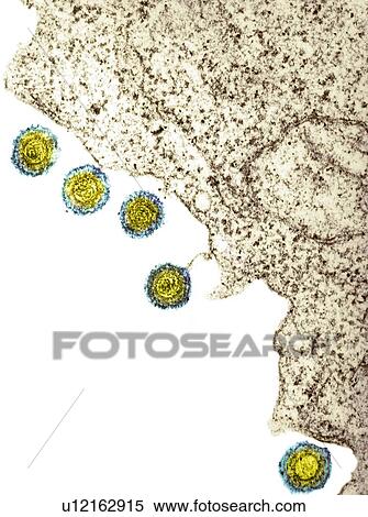 Herpes virus particles, TEM View Large Photo Image Stock Photography - Herpes virus particles, TEM. Fotosearch