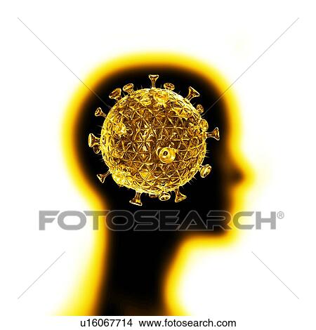 HIV infection, conceptual artwork View Large Photo Image Picture - HIV infection, conceptual artwork. Fotosearch
