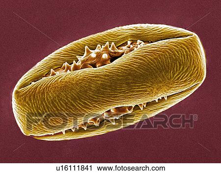 Horse chestnut pollen, SEM View Large Photo Image Stock Image - Horse chestnut pollen, SEM. Fotosearch