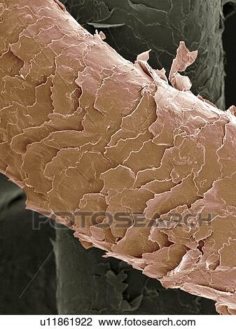 Stock Image - Human hair, SEM. Fotosearch
