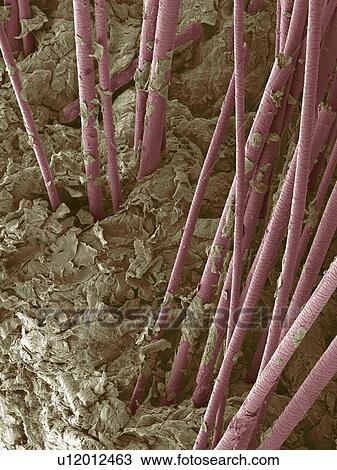 Human hair, SEM View Large Photo Image Stock Image - Human hair, SEM. Fotosearch