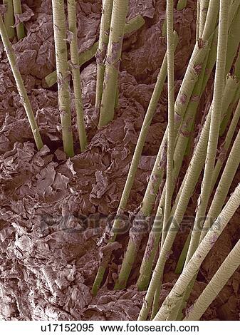 Stock Photography - Human hair, SEM. Fotosearch