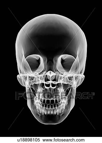 Stock Photography - Human skull, X-ray artwork. Fotosearch