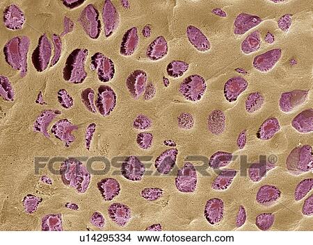 Picture - Hyaline cartilage, SEM. Fotosearch
