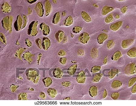 Hyaline cartilage, SEM View Large Photo Image Stock Photograph - Hyaline cartilage, SEM. Fotosearch
